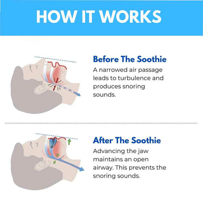 Anti Snoring Mouthpiece